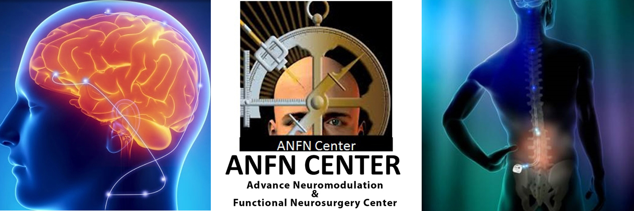 neuromodulation & deep brain stimulation neuromodulation & deep brain stimulation
